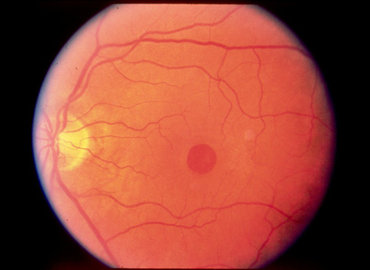 retina-duo-scan.jpg